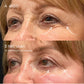 GlowLift Retinol Szemkörnyékápoló Stift