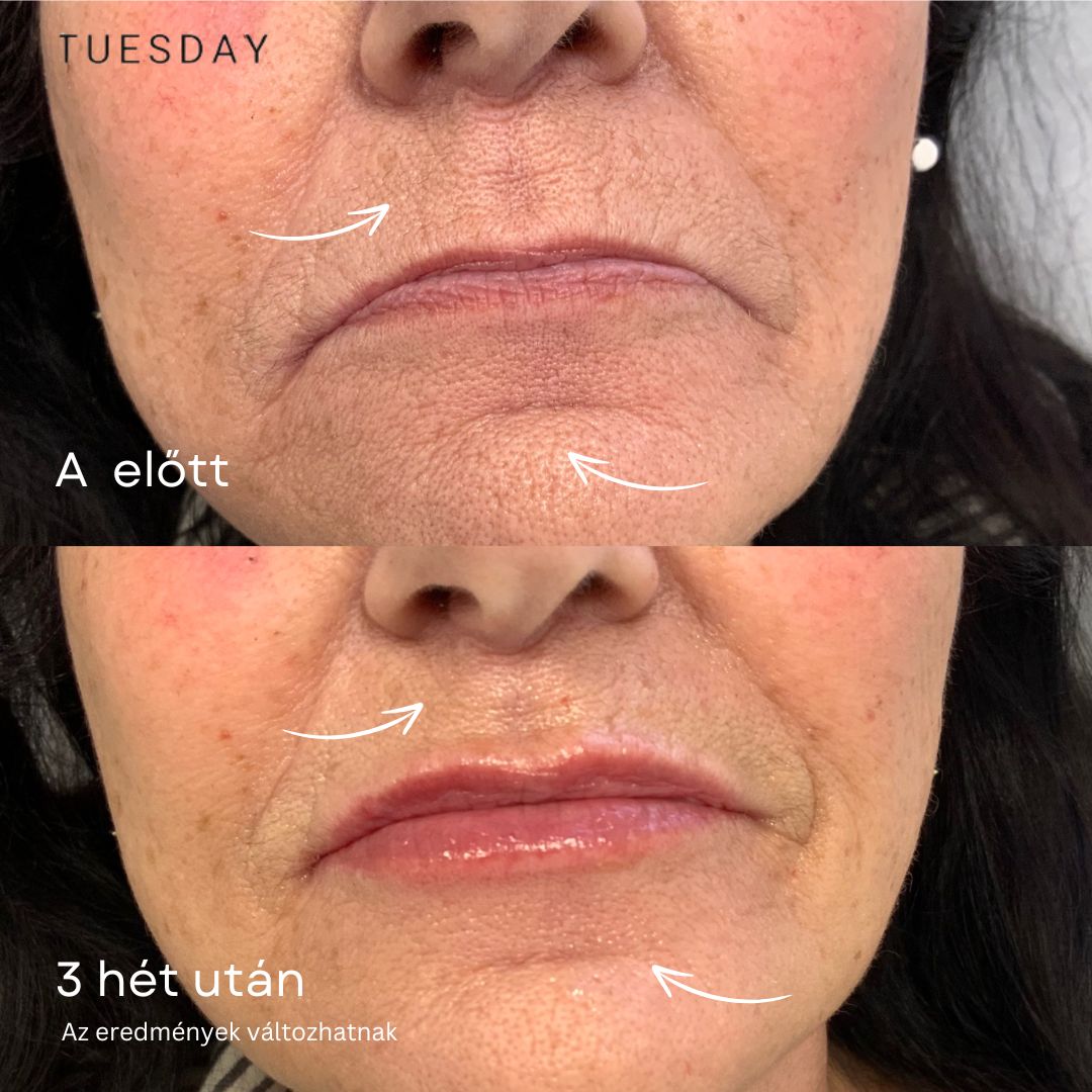 24K Arany Anti-Aging Szérum