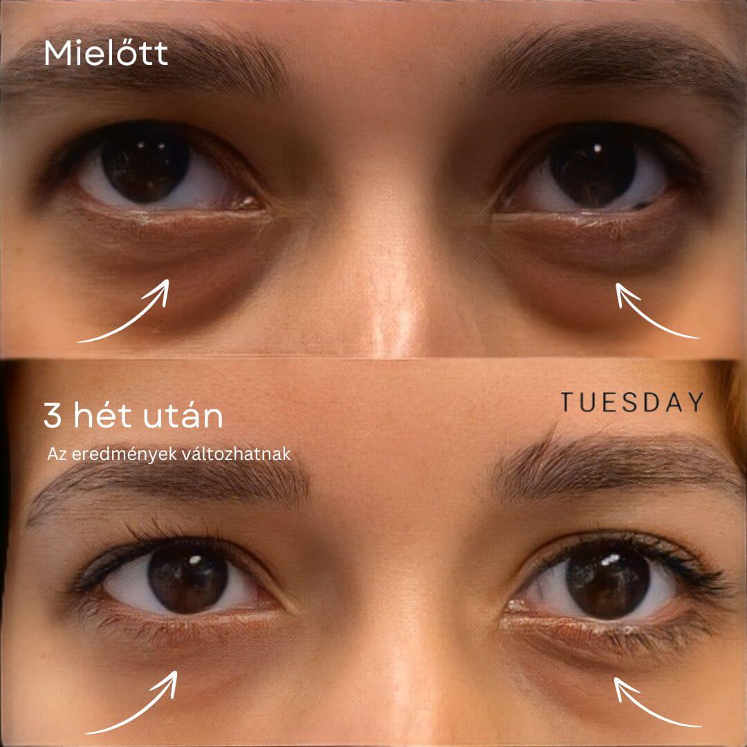 GlowLift Retinol Szemkörnyékápoló Stift