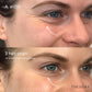 GlowLift Retinol Szemkörnyékápoló Stift